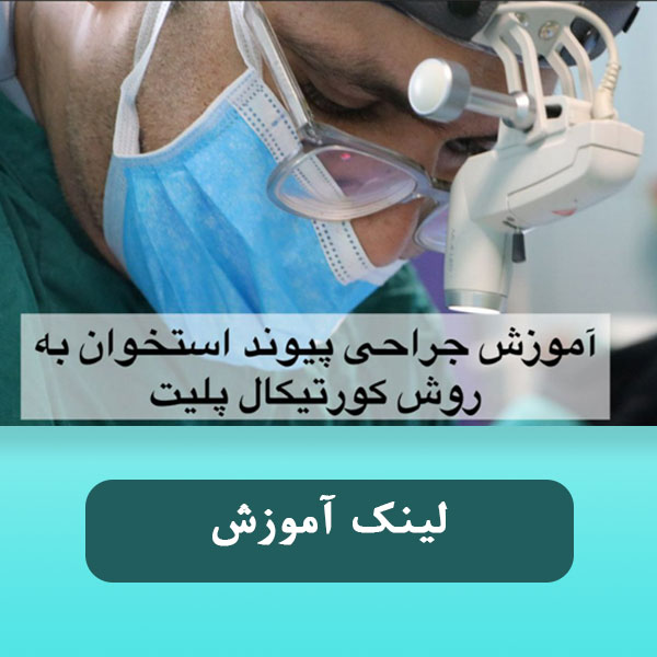 پیوند استخوان به روش کوتیکال