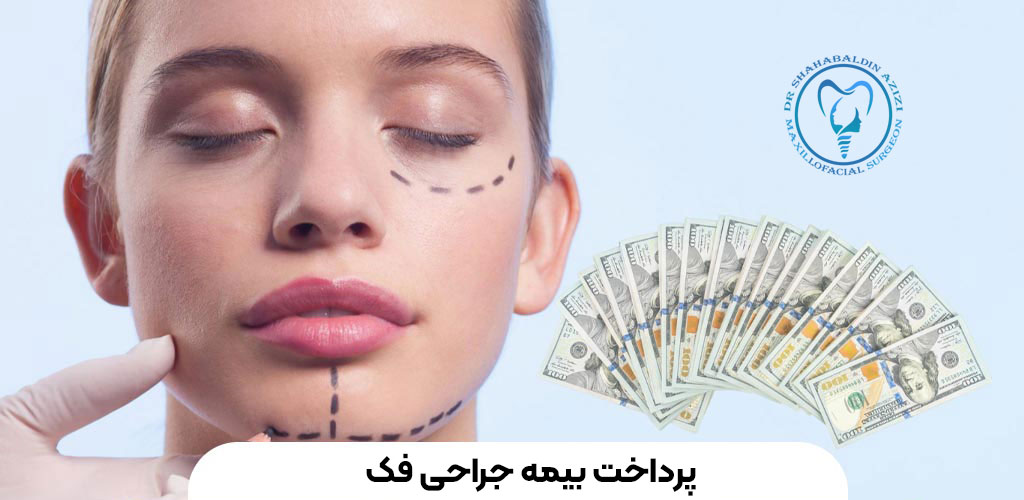 هزینه جراحی فک با بیمه