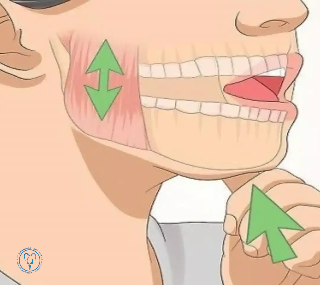 فیزیوتراپی پس از جراحی فک