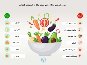 محدودیت های غذایی بعد از ایمپلنت دادن