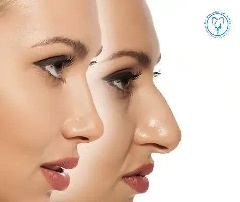 جراحی همزمان فک و بینی