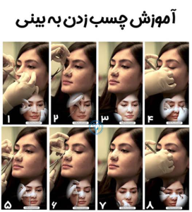 آموزش صحیح چسب بینی