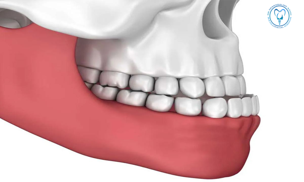 آندربایت