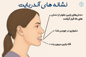 نشانه های آندربایت