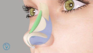 بازسازی ساختار بینی