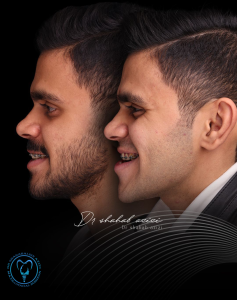 بهترین سن انجام جراحی فک